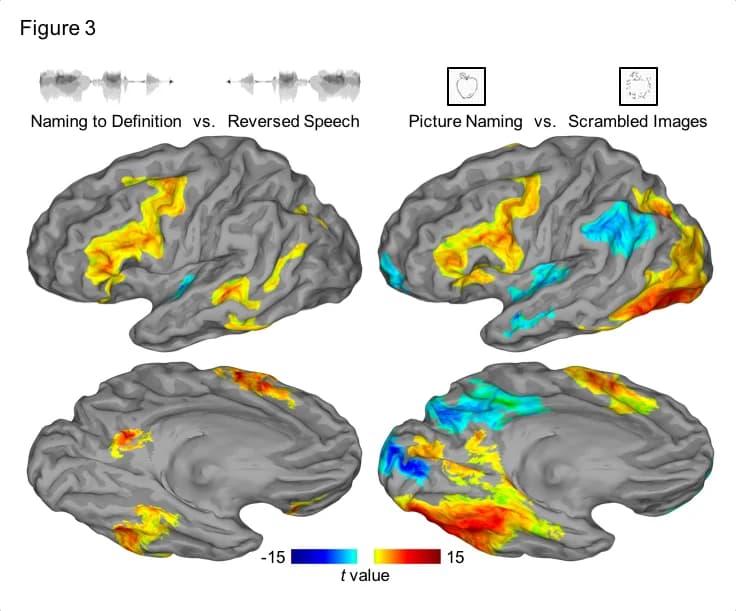 A lexical semantic hub for heteromodal naming in middle fusiform gyrus - Figure 3