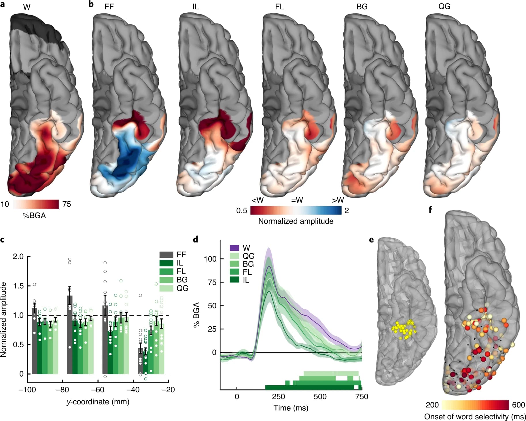 Spatiotemporal dynamics of orthographic and lexical processing in the ventral visual pathway - Figure 3