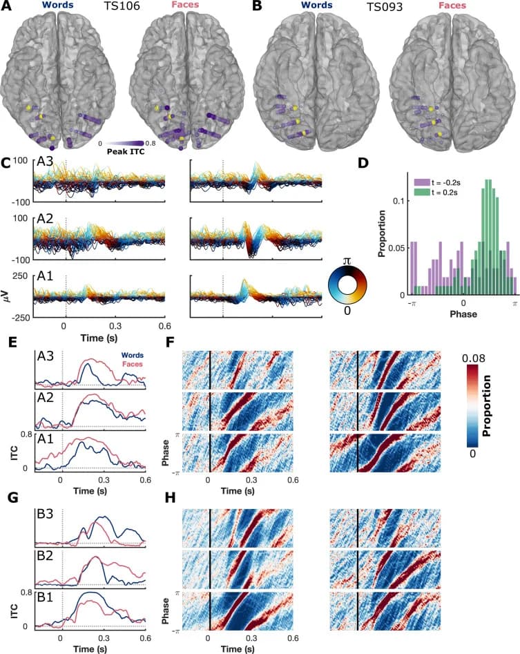 Event-related phase synchronization propagates rapidly across human ventral visual cortex - Figure 2