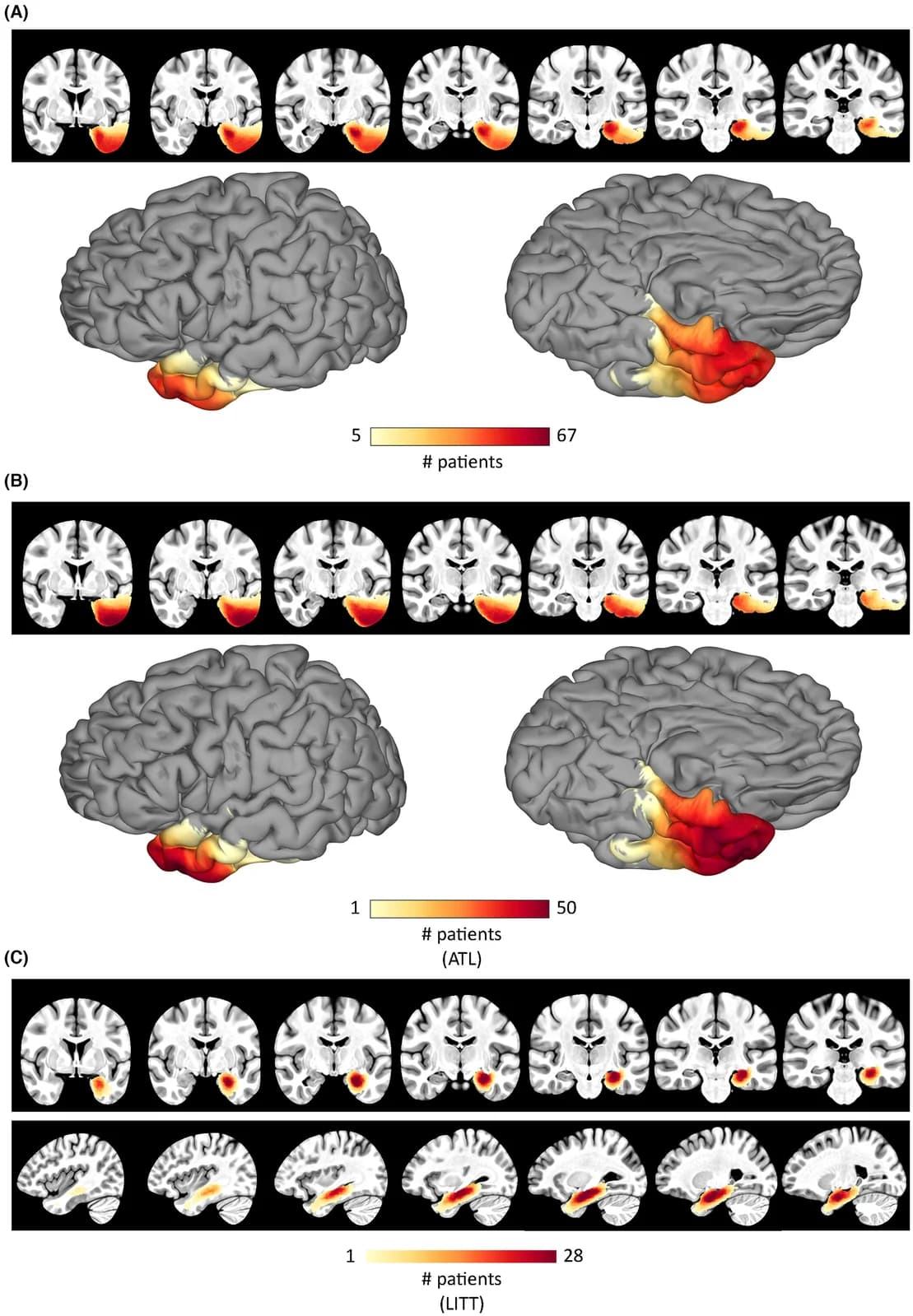 Critical role of the ventral temporal lobe in naming - Figure 1